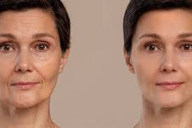 Química, edad y riesgo de rejuvenecer