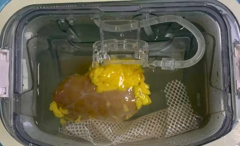 Científicos avanzan en un riñón universal compatible con cualquier tipo de sangre que podría reducir las listas de espera