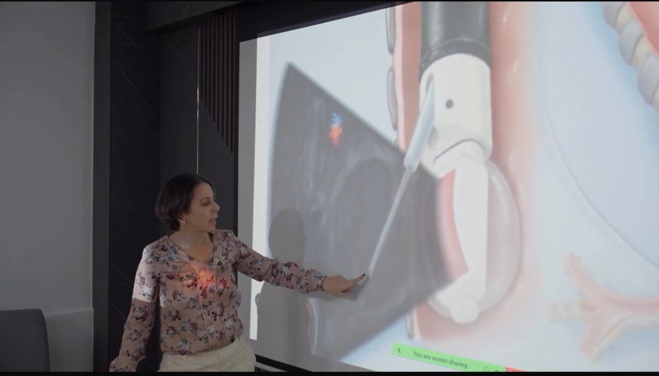 Introducen en RD tecnología para diagnóstico cáncer pulmón