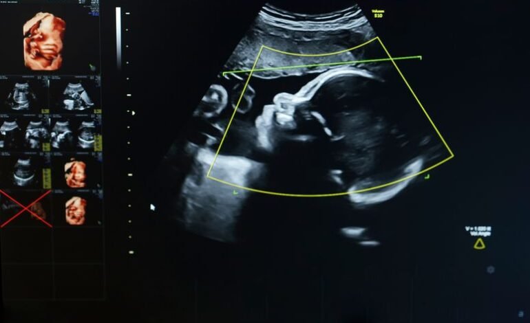 Los bebés antes de nacer están expuestos a “químicos eternos” y es peor de lo que pensábamos