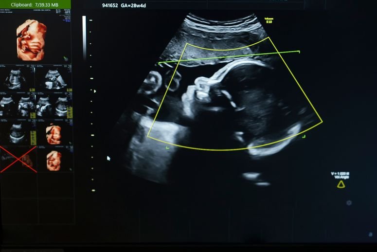 Los bebés antes de nacer están expuestos a “químicos eternos” y es peor de lo que pensábamos