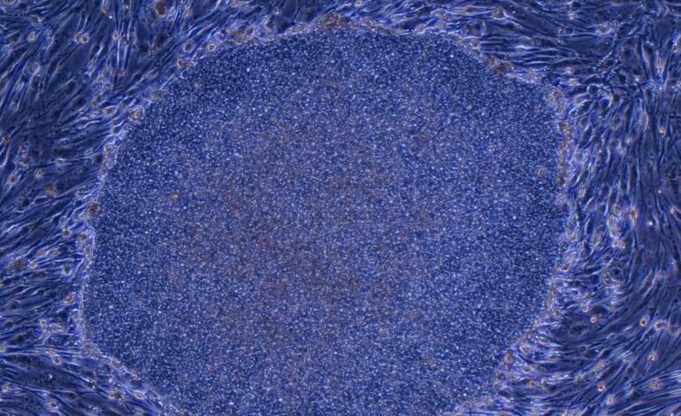 Japón aprueba los primeros tratamientos del mundo hechos con células humanas reprogramadas