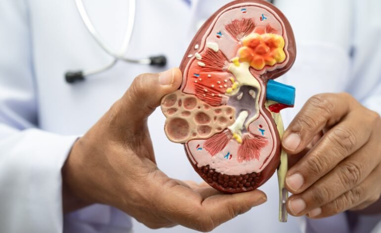 Nefróloga de Cleveland Clinic asegura que chequeos médicos son claves para proteger salud renal